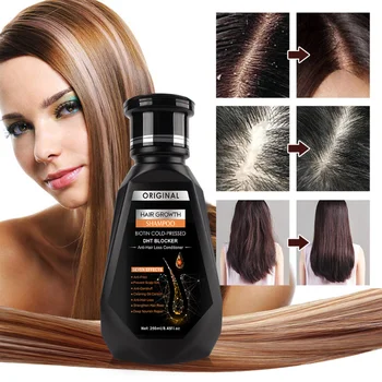 Грижа за косата Шампоан за растеж на косата етерично масло против косопад, бързо мощно възстановяване, гладкост на косата, джинджифил, грижа за кожата на главата, 1 бр.